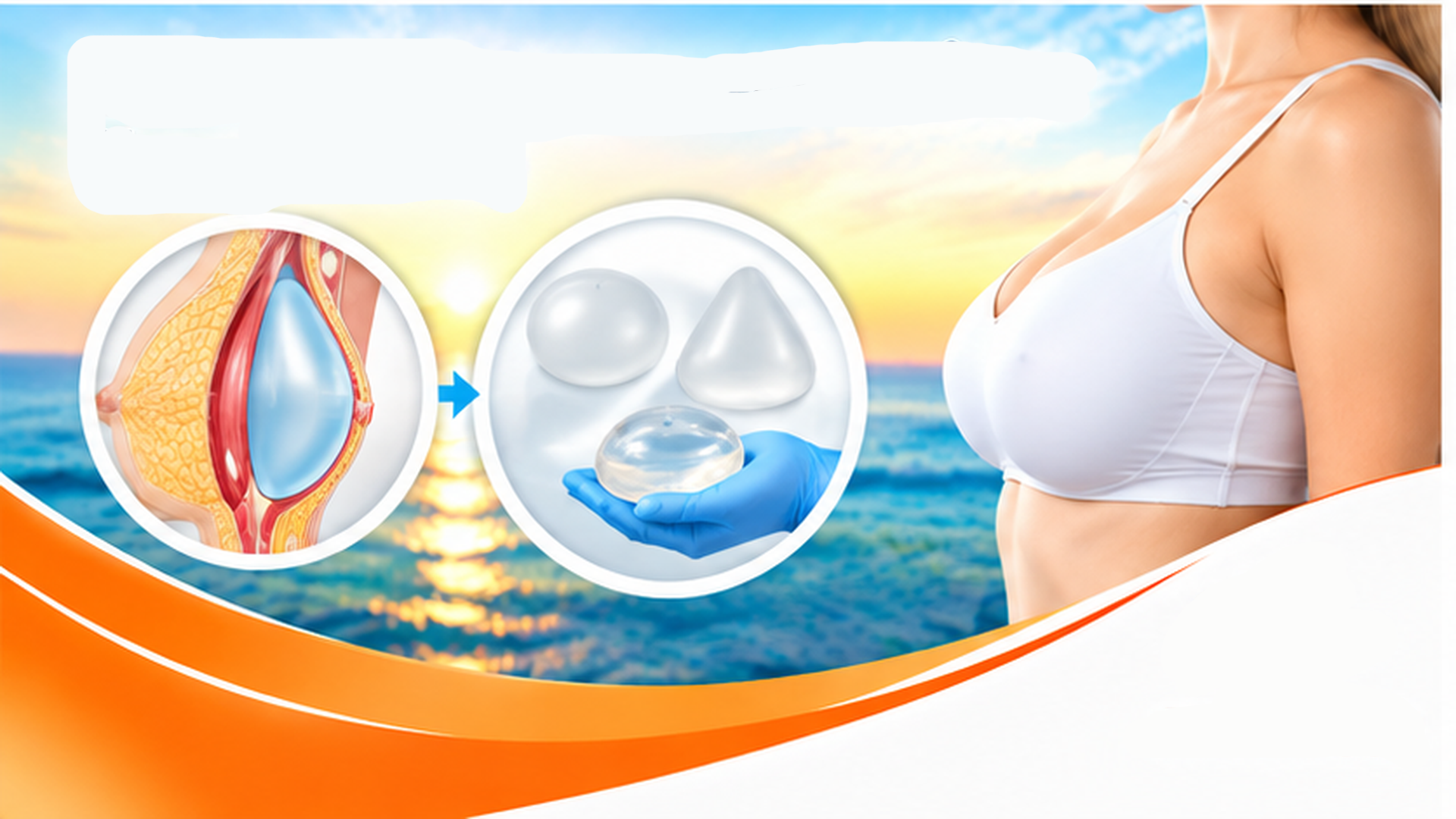 Breast Augmentation (Implants)