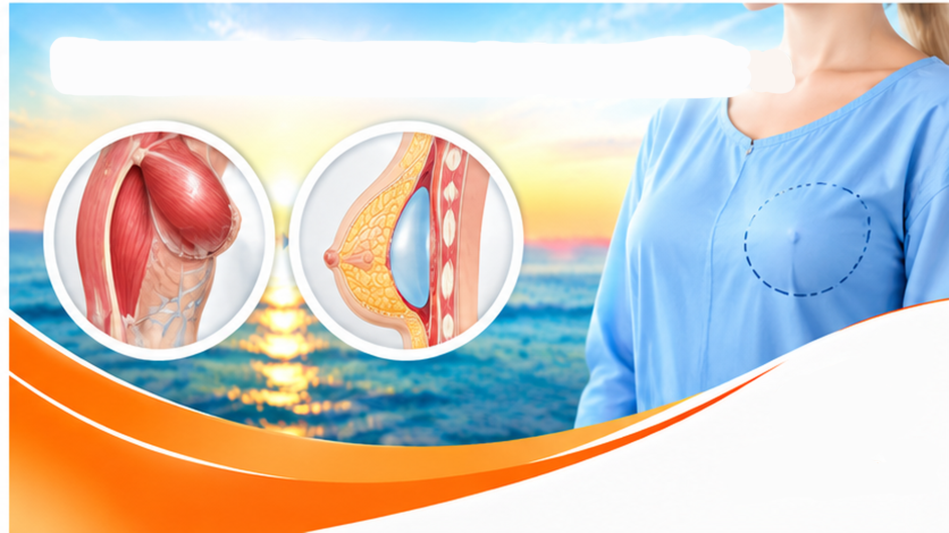 Breast Reconstruction