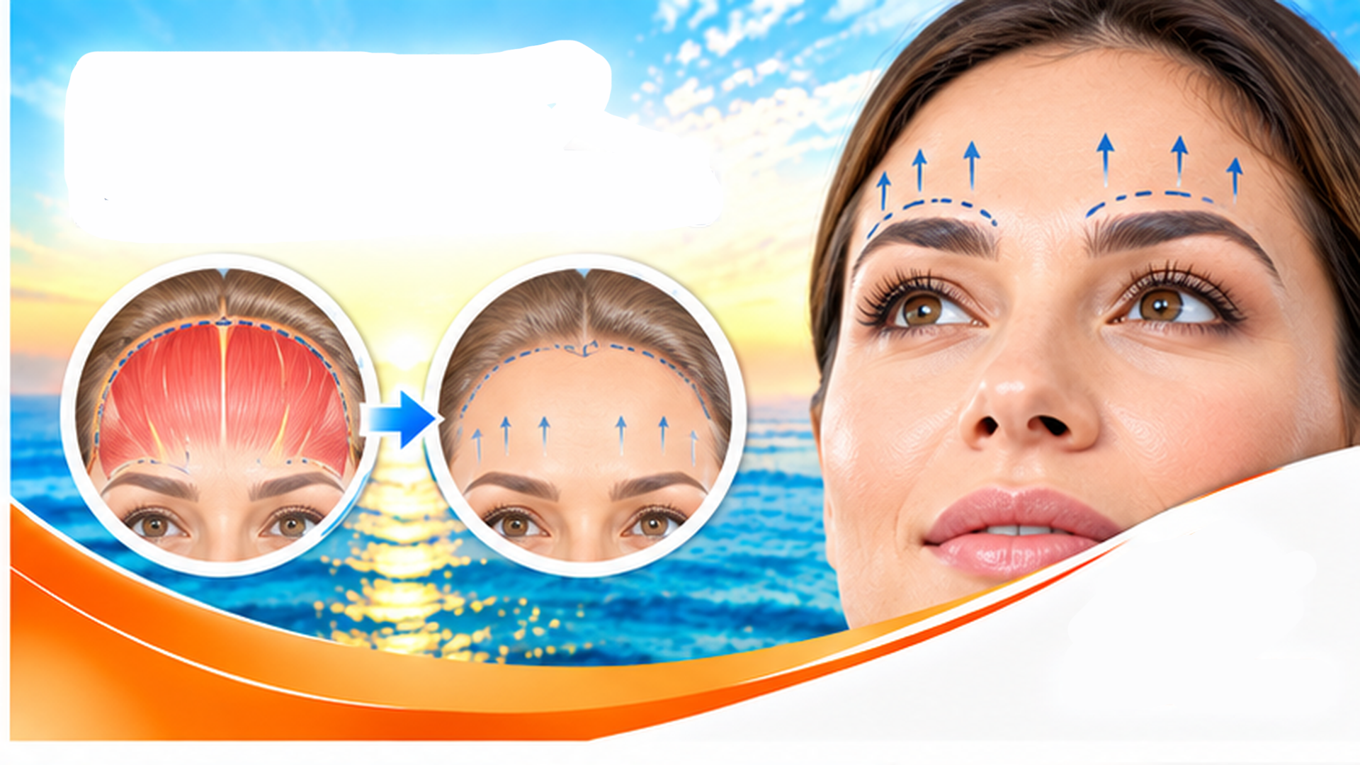 Brow Lift / Forehead Lift