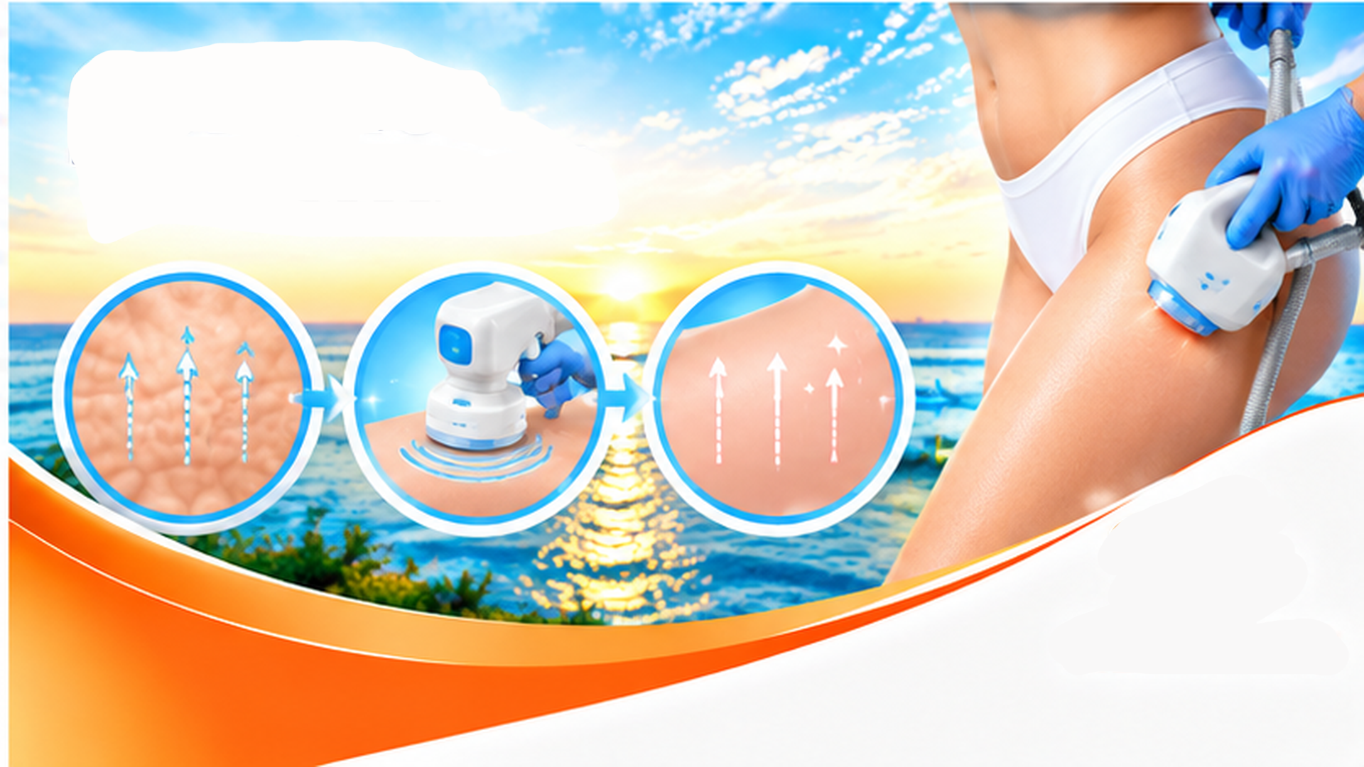 Cellulite Treatment