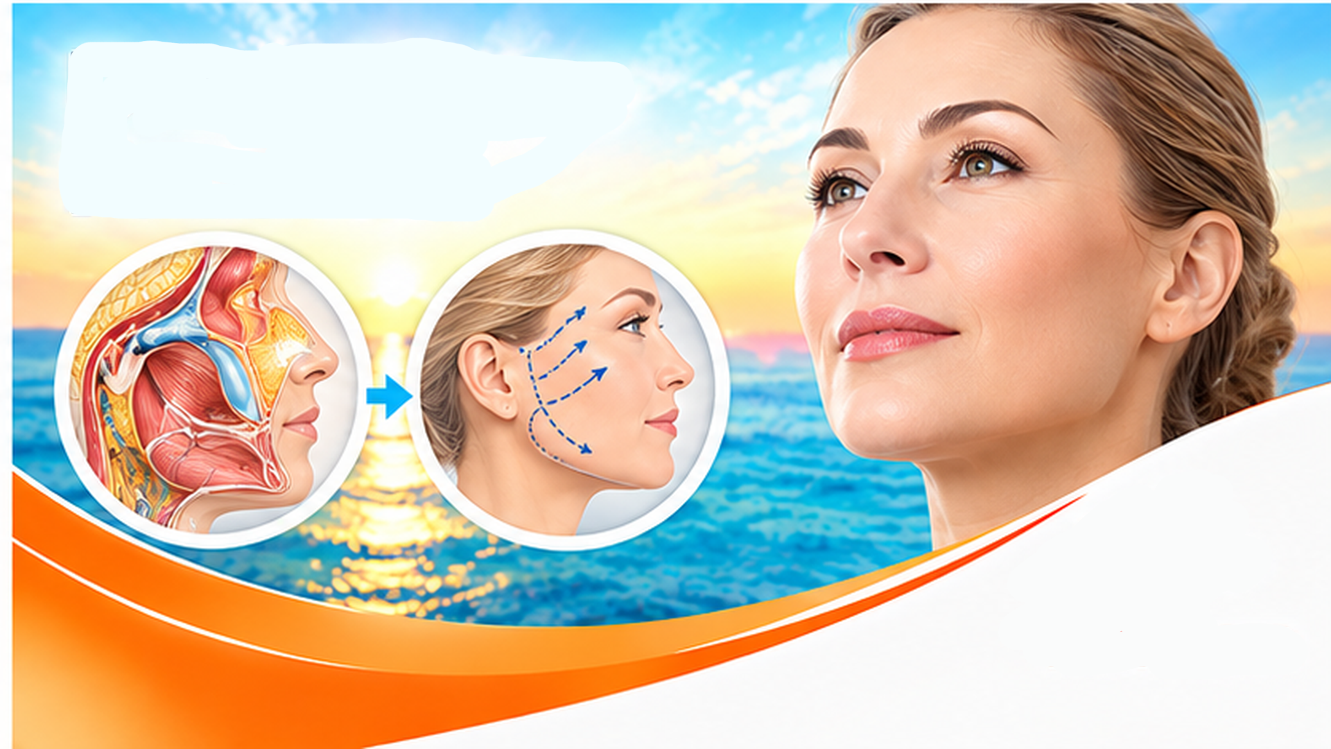 Deep Plane Face Lift