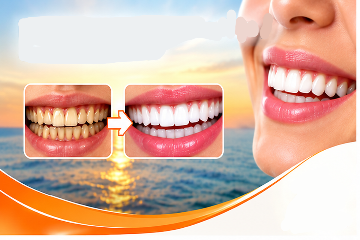 Full Mouth Reconstruction / Smile Makeover